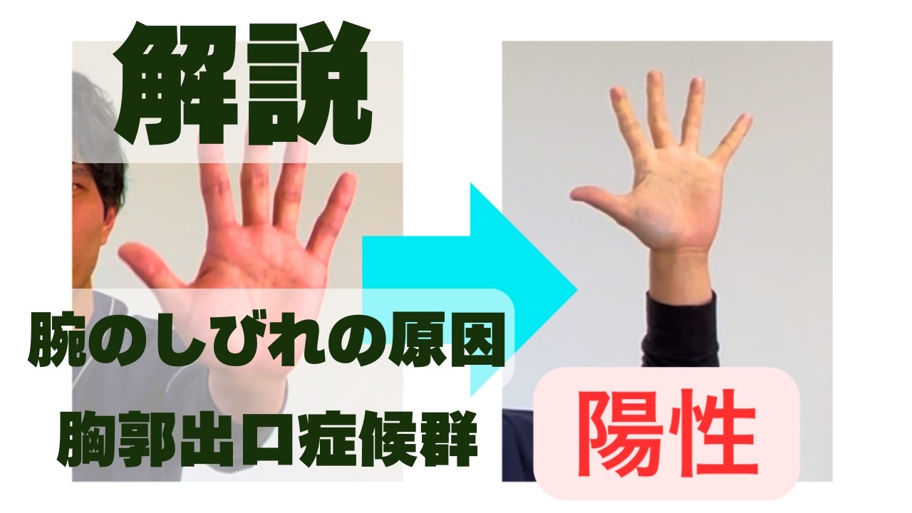 解説：腕のしびれの原因《胸郭出口症候群》