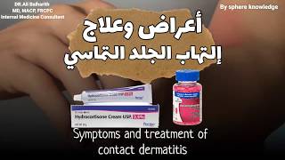 أعراض وعلاج #إلتهاب_الجلد_التماسي - Symptoms and treatment of #contact_dermatitis مع دكتور علي بالحا