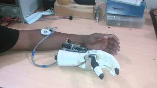 EMG based hand prosthesis