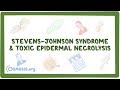 Stevens–Johnson Syndrome & Toxic Epidermal Necrolysis