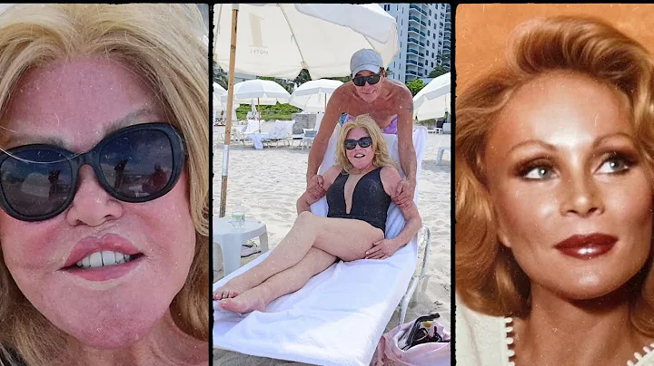 Jocelyn Wildenstein’s Real Face Revealed: See Her Pre-Transformation Throwback Photo!