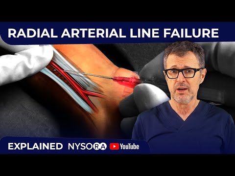 Vídeo: On és l'artèria braquial per a la pressió arterial?