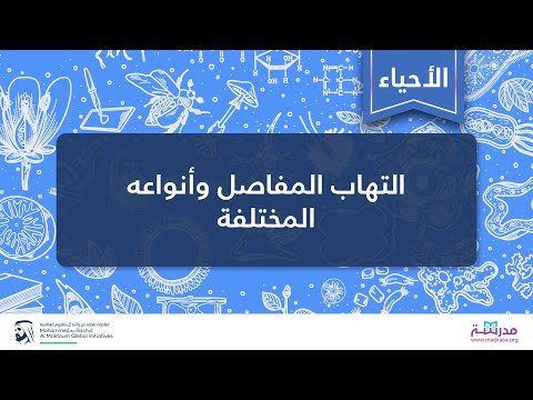 التهاب المفاصل وأنواعه المختلفة | الأحياء العامة | الأمراض العضلية الهيكلية