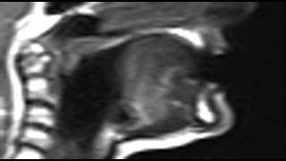 Ultrax MRI vl uvular plosive
