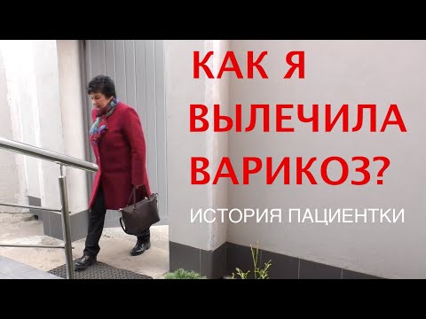 Как я вылечила варикоз? История пациентки!