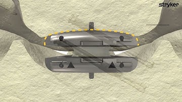 Stryker: Rhine Animation Video