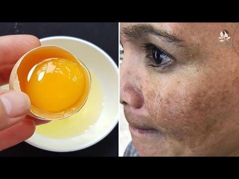Video Lấy 1 Quả Trứng Gà Làm Thế Này, Bí Quyết Trị Sạch Nám... - youtube
