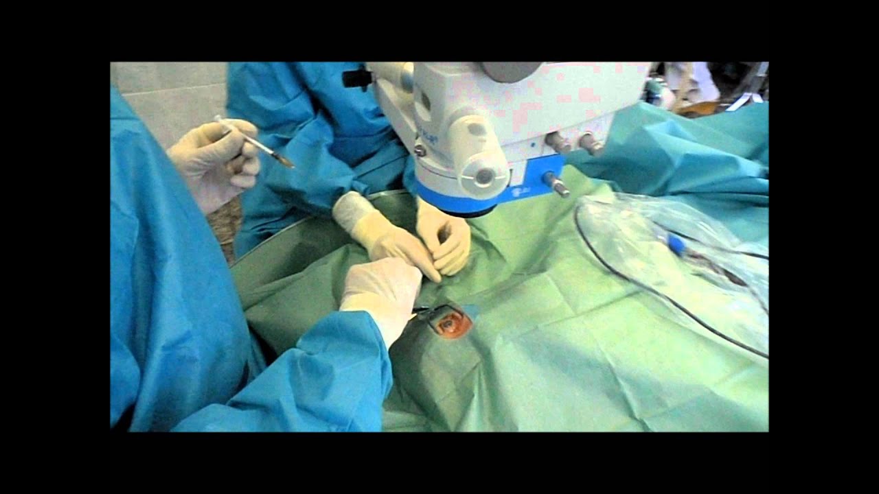 Лечение диабетической ретинопатии методом инъекций - YouTube