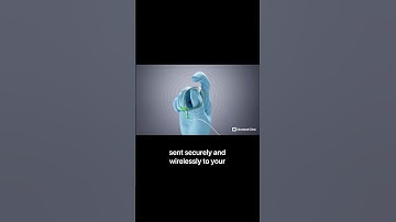 Wireless, catheter-free device to monitor bladder dysfunction.