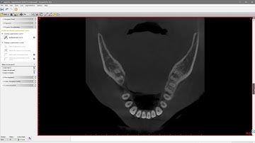 Create the panoramic curve step2