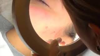 HydraFacial + Blue Light Therapy at Advanced Specialty Care