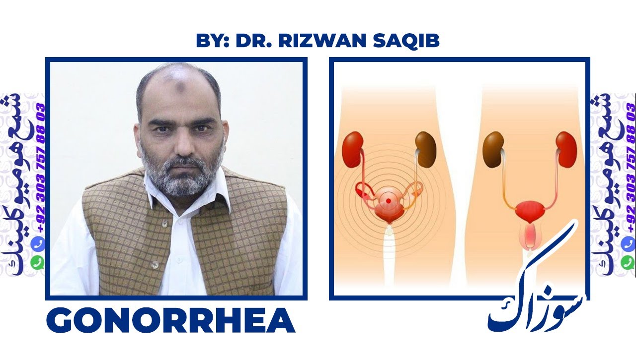 Gonorrhea || By Dr. Rizwan Saqib || In Urdu/Hindi