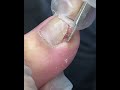 Satisfying Pedicure Routine | Gentle Toenail Care  #fypシ #fypシ #pedicure #nailcareereducation