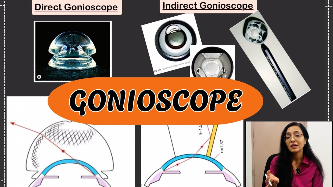 Gonioscope: Principle, Types and Comparisons | Angle of Anterior Chamber -Quick Guide