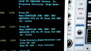 Decoding hospital paging system.