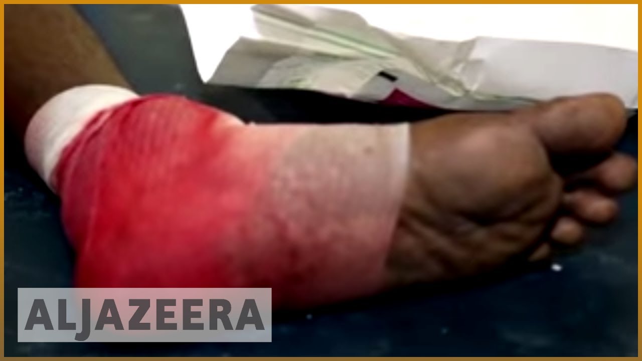 🇸🇴 تفجيران بسيارتين مفخختين يسفران عن مقتل نحو 30 شخصاً في مقديشو الصومالية
