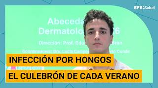 Infección por hongos, el culebrón de cada verano