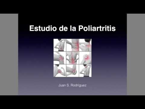 Poliartritis Estudio Diagnóstico