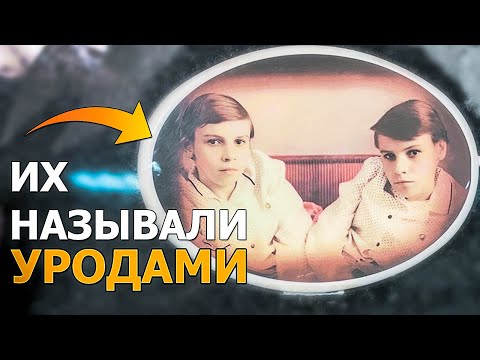 видео: Страшная и трагичная судьба сиамских близнецов. Могилы знаменитостей на кладбищах Москвы 2024