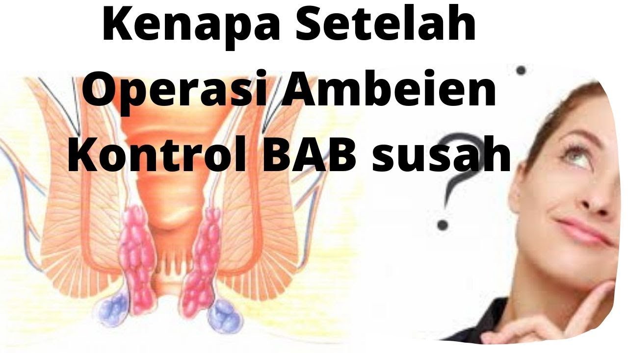 Kenapa Setelah Operasi Ambeien Kontrol BAB susah