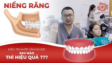 Niềng Răng Điều Trị Khớp Cắn Ngược Khi Nào Hiệu Quả Nhất? | Nha khoa Đặng Xá - S-Dental