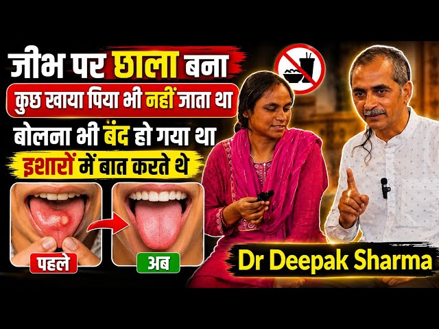 जीभ के छालों से बोलना भी बंद हो गया था | Ayurvedic Treatment
