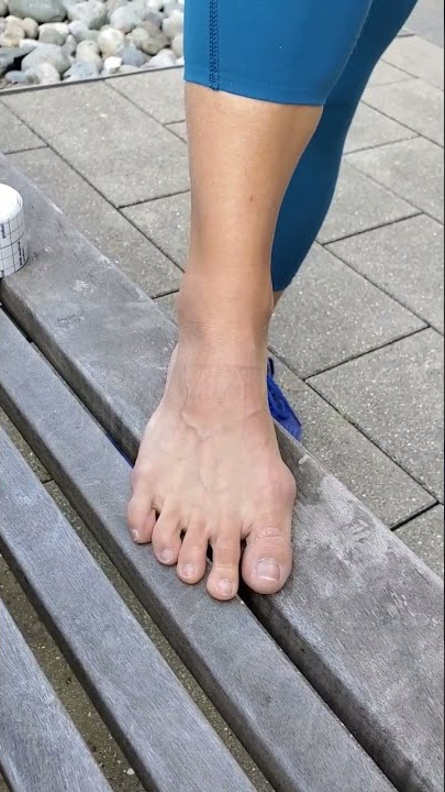 Get back to walking faster after an #anklesprain! Watch 'Tape Your Sprained Ankle' on our channel!