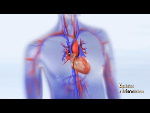 Video: Caratteristiche Del Carico Sintomatico Nella Fibrillazione Atriale Con Concomitante Insufficienza Cardiaca