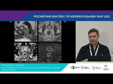 КАК ПРАВИЛЬНО ОЦЕНИТЬ