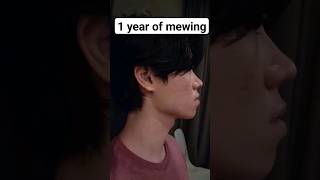 1 year of mewing 🤐