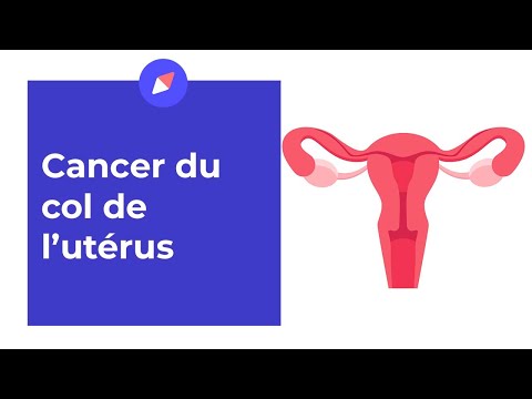 Vidéo: Comment reconnaître les symptômes du cancer de l'utérus : 11 étapes (avec photos)