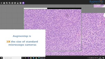 Fast manual scanning directly from your microscope with Augmentiqs