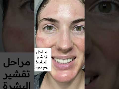 فيديو: من يقوم بتقشير البشرة؟