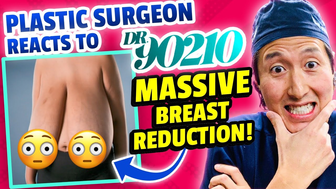 Plastic Surgeon Reacts to INCREDIBLE Breast Reduction! 