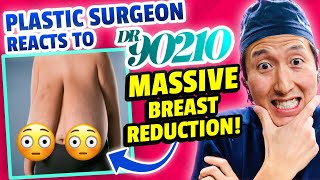 Plastic Surgeon Reacts to INCREDIBLE Breast Reduction!