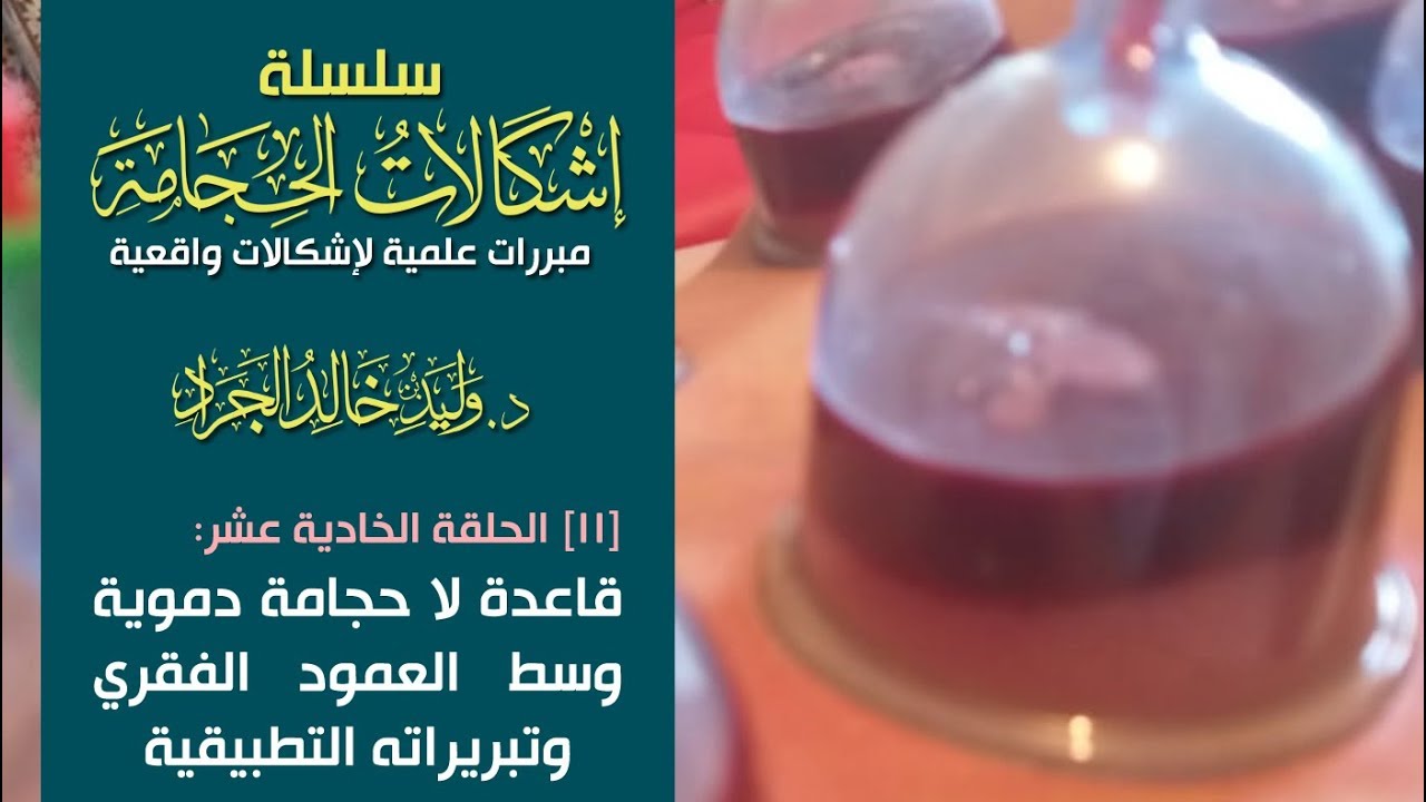 #سلسلة_إشكالات_الحجامة [11] قاعدة: (لا حجامة دموية وسط العمود الفقري) وتبريراته التطبيقية