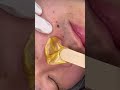 #asmr #asmrsounds #wax #フェイスワックス#うぶ毛#大阪天王寺