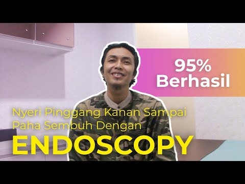 Nyeri Pinggang Kanan Sampai Paha Sembuh Dengan Endoscopy (95% Berhasil). 