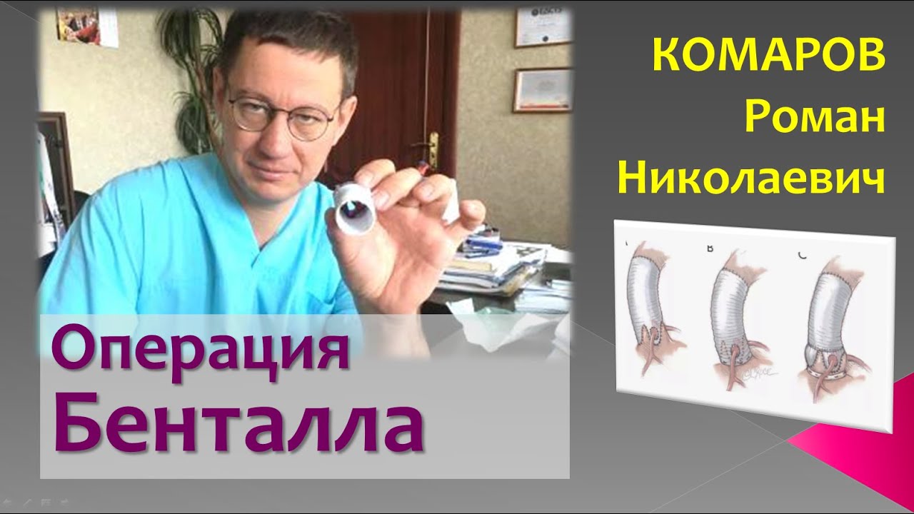 Операция Бенталла/Одна доза кардиоплегии Нормакор/Bentall procedure ...