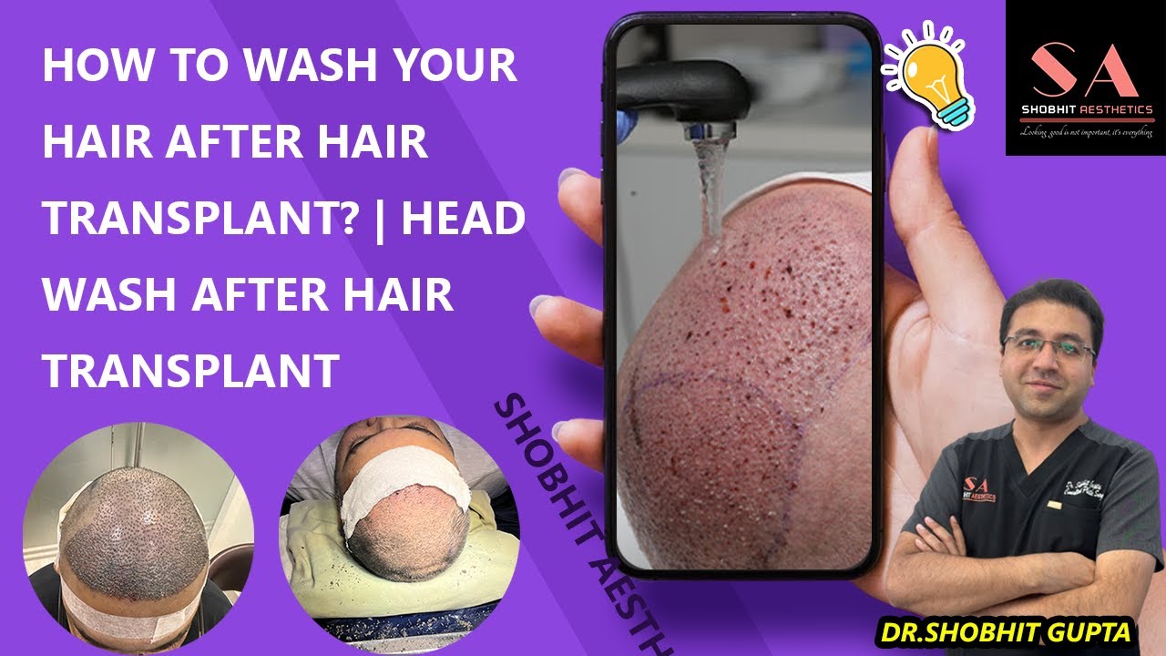 How To Wash Your Hair After Hair Transplant Head Wash After Hair