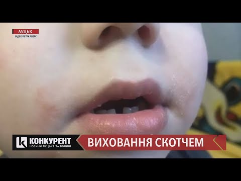 Заклеювала рот скотчем: у луцькому дитсадку вихователька знущалася з дітей