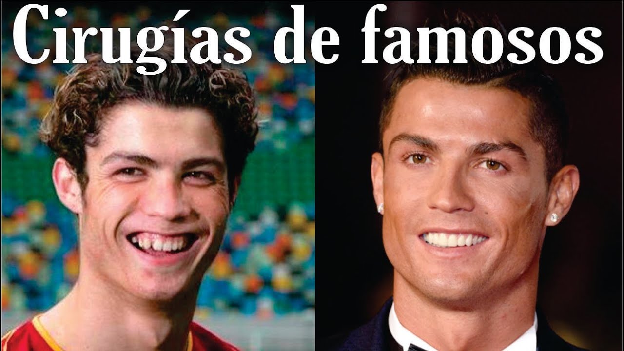 Las MEJORES CIRUGÍAS PLÁSTICAS de FAMOSOS 👩‍🦰 ANTES y DESPUÉS de FAMOSOS 🌹 Medicina Extraordinaria