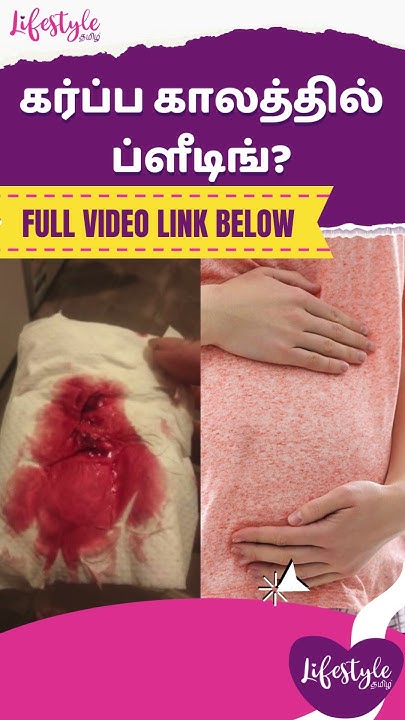 is-bleeding-during