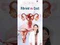 Fibroid vs Ovarian Cyst | What’s the Difference between Fibroid and cyst
