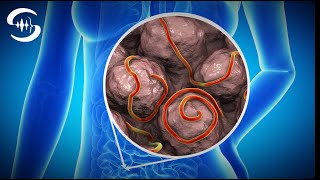 Worm frequency and parasite cleansing frequency (128 Hz music therapy)