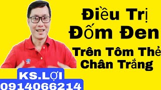 Đốm Đen Trên Tôm Thẻ/ Phương Pháp Điều Trị Hiệu Quả. #Nguyễn Đắc Lợi #0914066214