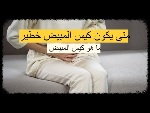 متى يكون كيس المبيض خطير ما هو كيس المبيض وما هي مدى خطورته وطرق علاجه