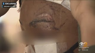Victim of violent 2021 attack outside Harlem liquor store speaks out