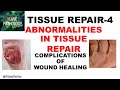 TISSUR REPAIR Part 4: Abnormalities in tissue repair