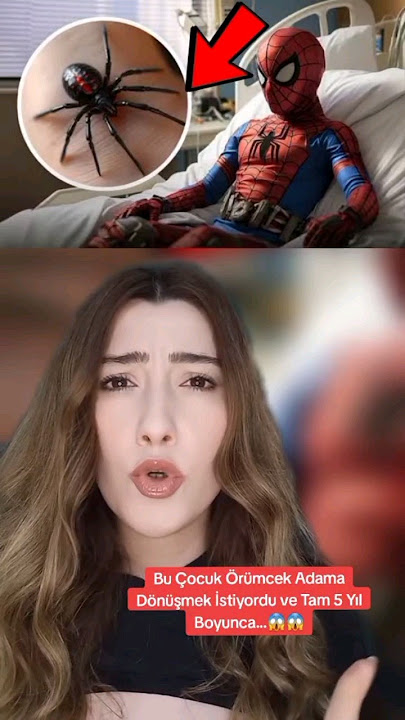 THE INTERESTING STORY OF THE CHILD WHO WANTED TO TURN INTO SPIDER-MAN 😱😱 #shorts #tiktok #fyp